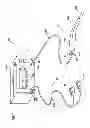 Fig. 02 - Electrosurgical wand and related method and system