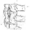 Fig. 01 - DYNAMIC TISSUE HOLDING DEVICE WITH LOW PROFILE SPRING