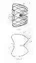 Fig. 02 - OCCLUSION DEVICE FOR AN ATRIAL APPENDAGE