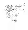 Fig. 06 - Endocardial pacing devices and methods useful for resynchronization and defibrillation