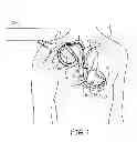 Fig. 02 - System and method for identifying lead dislodgement