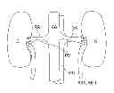 Fig. 02 - METHODS FOR MONOPOLAR RENAL NEUROMODULATION