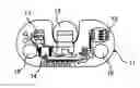 Fig. 01 - PERCUTANEOUS NEUROSTIMULATOR