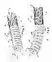 Fig. 02 - Stent and method for maintaining the area of a body lumen