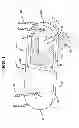 Fig. 02 - Flipping-type graft fixation device and method