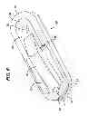 Fig. 07 - Flipping-type graft fixation device and method