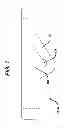 Fig. 08 - Flipping-type graft fixation device and method