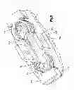 Fig. 06 - Expandable interbody spacer device