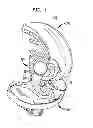Fig. 02 - Stabilized knee prosthesis