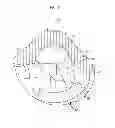 Fig. 09 - Stabilized knee prosthesis