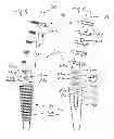 Fig. 07 - Prosthesis for arthrodhesis