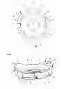Fig. 02 - Prosthetic acetabular cup impaction plate