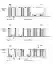 Fig. 11 - Systems and methods for sensing and tracking radiation blocking objects on a surface