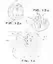 Fig. 09 - OPERATIVELY TUNING IMPLANTS FOR INCREASED PERFORMANCE