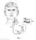 Fig. 02 - METHOD AND APPARATUS FOR INTEGRATING IMPLANTABLE MEDICAL DEVICE DATA