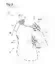Fig. 04 - Garment