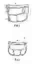 Fig. 02 - FACEMASK AFFIXED TO A BASEBALL CAP