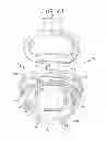 Fig. 06 - Shoulder pads