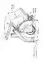 Fig. 10 - Plumbing fixture with flush valve actuator and methods for calibrating same