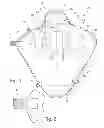 Fig. 02 - Infant and preemie swaddling wraps