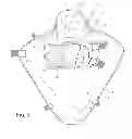 Fig. 03 - Infant and preemie swaddling wraps