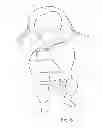 Fig. 06 - Infant and preemie swaddling wraps