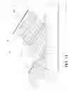 Fig. 12 - Articulating bed with flexible mattress support