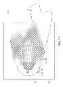 Fig. 12 - Shoe with composite upper and foam element and method of making same