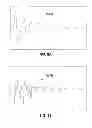 Fig. 08 - Electronic percussion device and method
