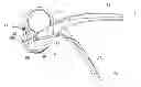 Fig. 01 - Garlic press