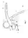 Fig. 09 - Garlic press
