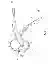 Fig. 10 - Garlic press