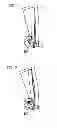 Fig. 07 - Rail vehicle having an attached deformation zone