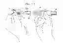 Fig. 09 - Safety drug handling device
