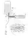 Fig. 32 - Safety drug handling device