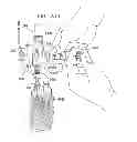 Fig. 48 - Safety drug handling device
