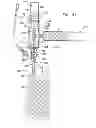 Fig. 67 - Safety drug handling device