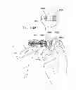 Fig. 71 - Safety drug handling device