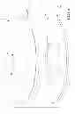 Fig. 06 - Rupture disc having laser-defined reversal initiation and deformation control features
