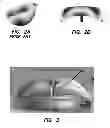 Fig. 04 - Microfabrication of high quality three dimensional structures using wafer-level glassblowing of fused quartz and ultra low expansion glasses