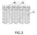 Fig. 04 - METHOD OF LAYERED CONSTRUCTION OF POLYMERIC MATERIAL THROUGH OPEN-CELL POROUS MATERIAL MATRIX