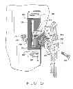 Fig. 06 - Wheelchair back mounting assembly