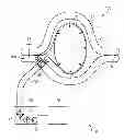 Fig. 01 - Control of a pressure of a local coil in relation to an object under examination