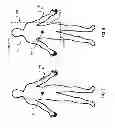 Fig. 11 - Human tracking system