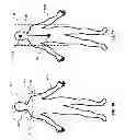 Fig. 12 - Human tracking system