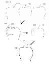 Fig. 11 - Motion blur compensation