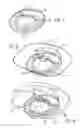 Fig. 06 - Lens with controlled backlight management