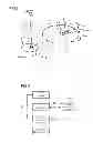 Fig. 02 - Method for correcting metal artifacts in x-ray imaging, and x-ray device