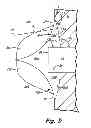 Fig. 06 - Inlet cutbacks for high speed gear pump