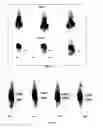 Fig. 04 - Phospholipid analogs as diapeutic agents and methods thereof